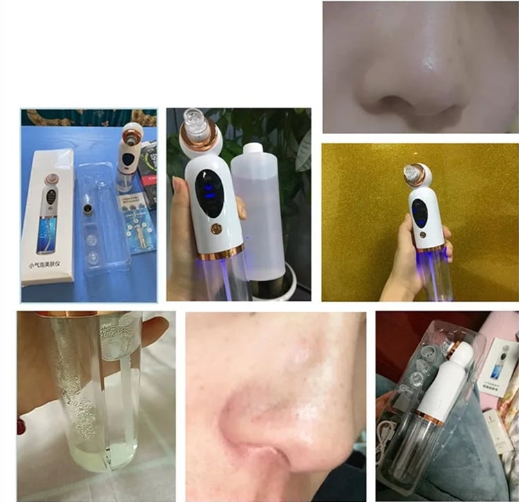 Blink Small Bubble Blackhead Remover