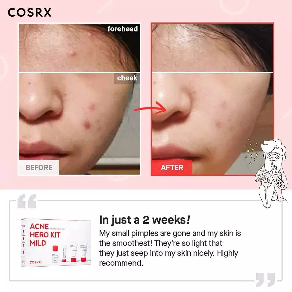 Cosrx Acne Hero Kit-Mild (75g)