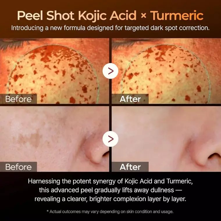Dr. Melaxin Peel Shot Exfoliating Kojic Acid Turmeric Serum (80ml)