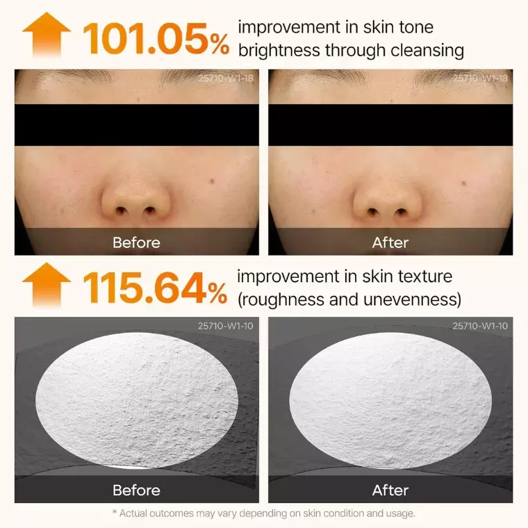 Dr. Melaxin Peel Shot Exfoliating Kojic Acid Turmeric Serum (80ml)