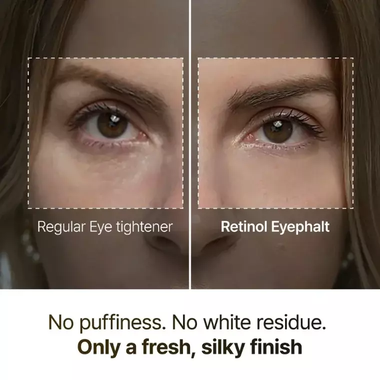 Dr. Melaxin Eyephalt Retinol Eyebag Cream (10gm)