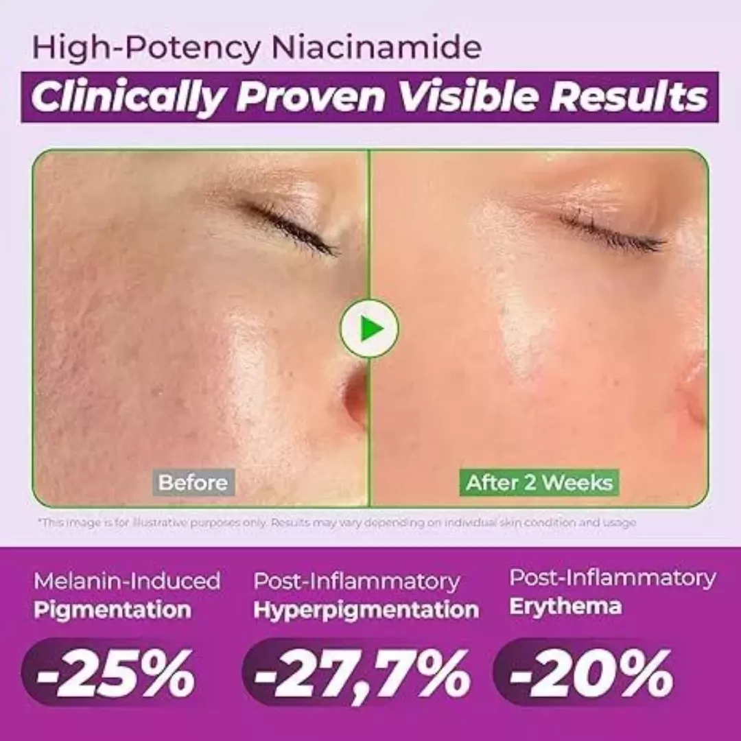 Jumiso Niacinamide Trial Kit