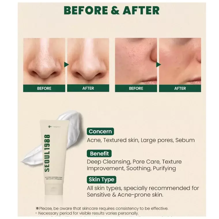 K Secret Seoul 1988 Cleansing Foam Pine Cica 1% + Probiotics (150ml)
